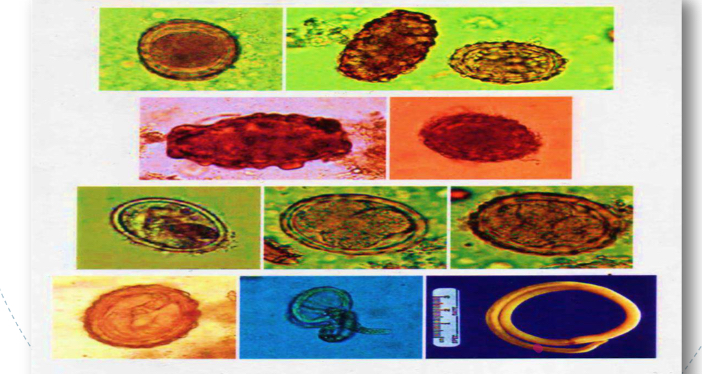 <p>parasite under microscope </p>