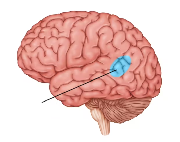term image