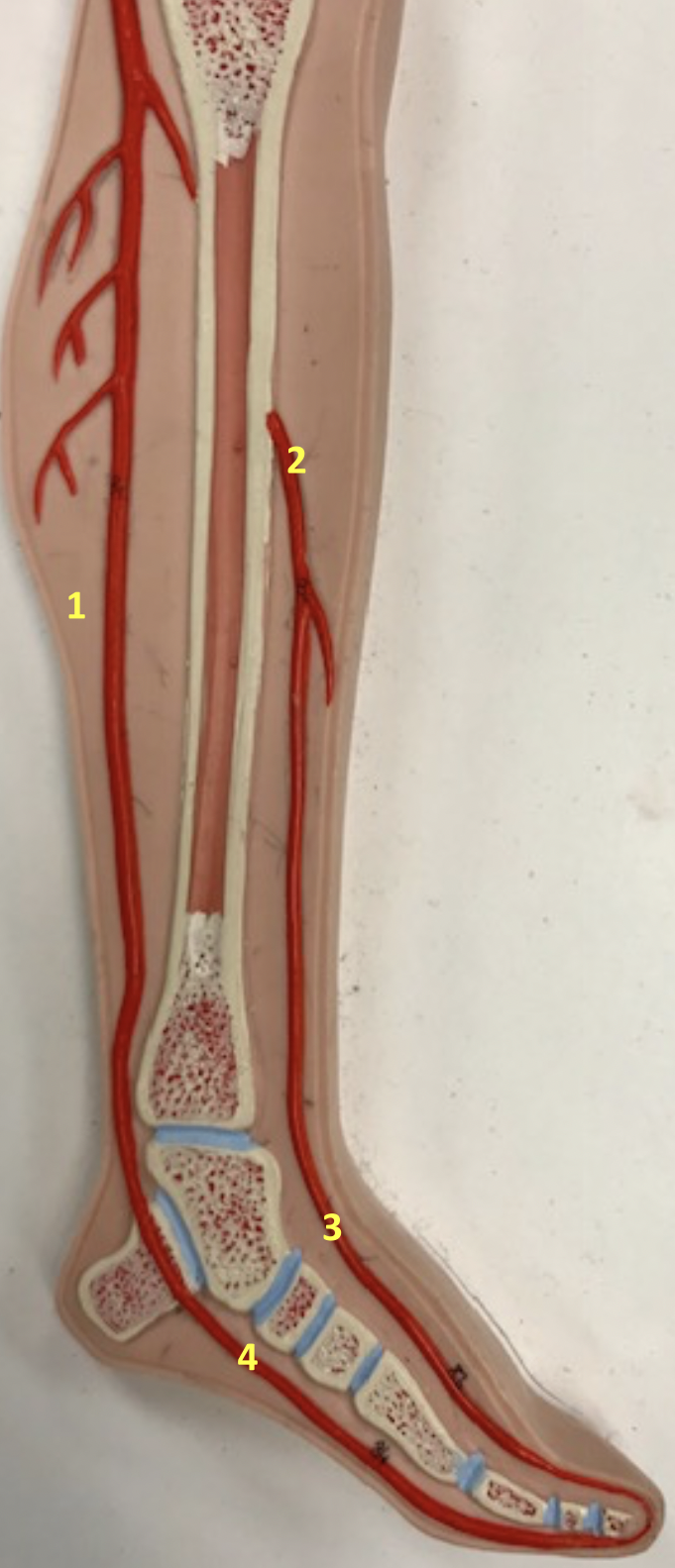 <p>Identify blood vessel 1</p>