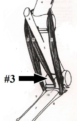 <p>What is this muscle? What joints does it move? Where does it originate and insert? (3)</p>