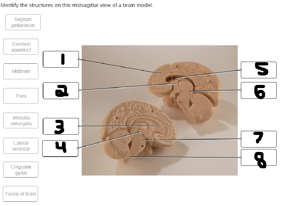 <p>whats labeled #1</p>