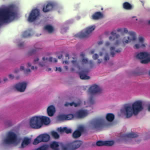 term image