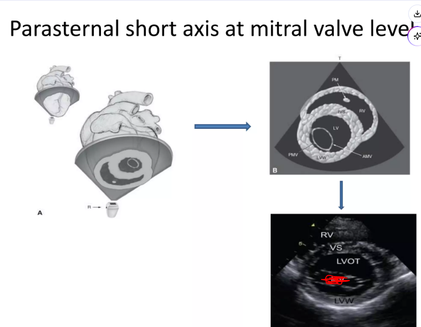 <p>Right parasternal short axis at level of mitral valve</p>