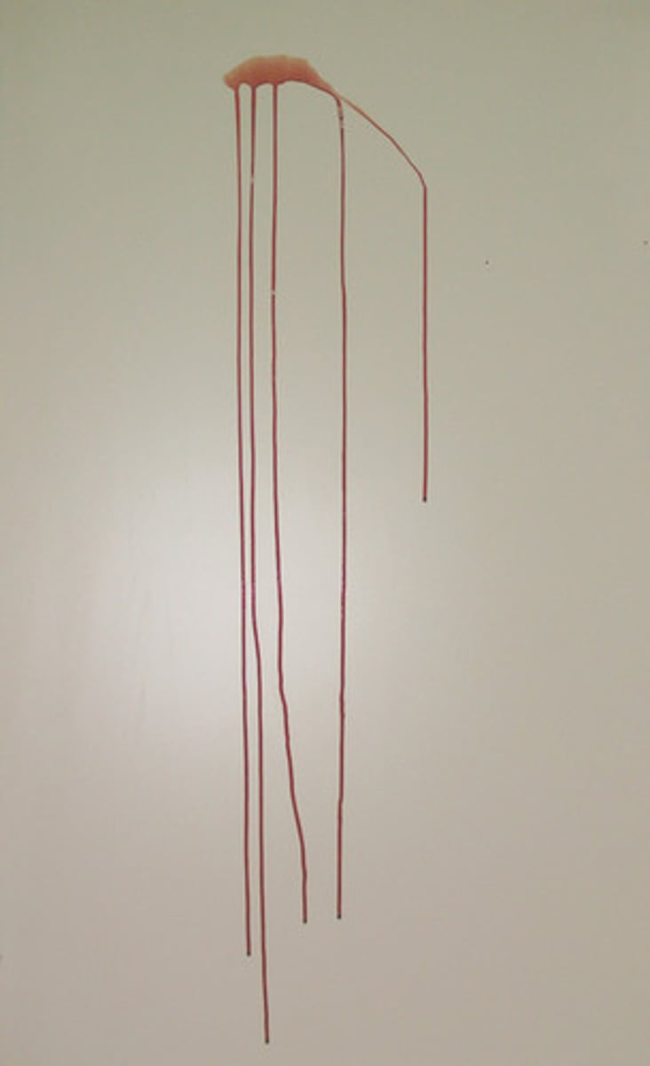 <p>A change in the shape and direction of a bloodstain due to the influence of gravity or movement of the object.<br><br>DESCRIPTION: This pattern was generated by drawing blood into a large-bore syringe and projecting it at the target.<br><br>There was enough volume to allow the excess blood to collect and flow down the target.</p>