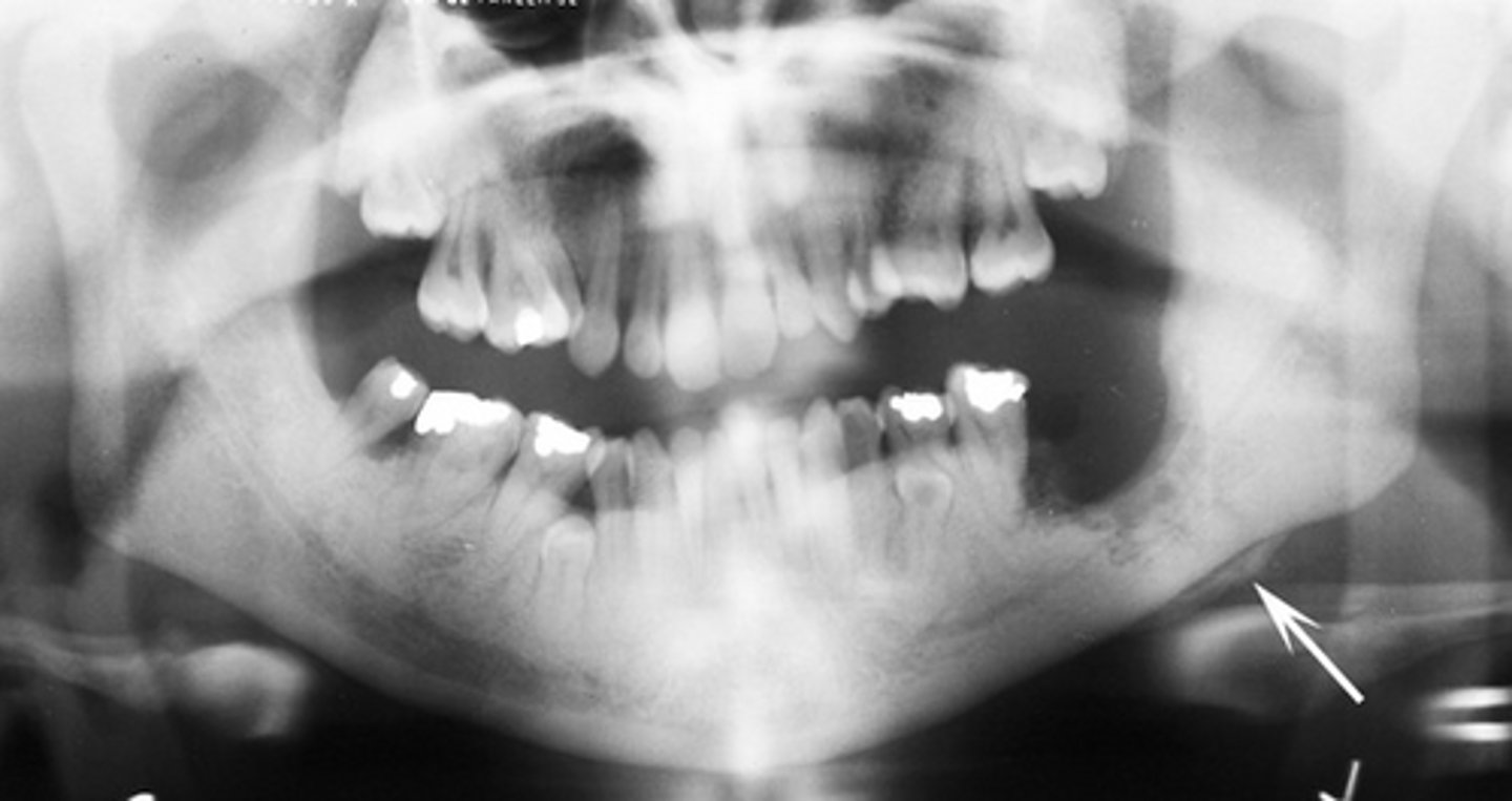 <p>What is this and how might you treat it?</p>