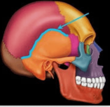 <p>Q. What suture is this?</p>