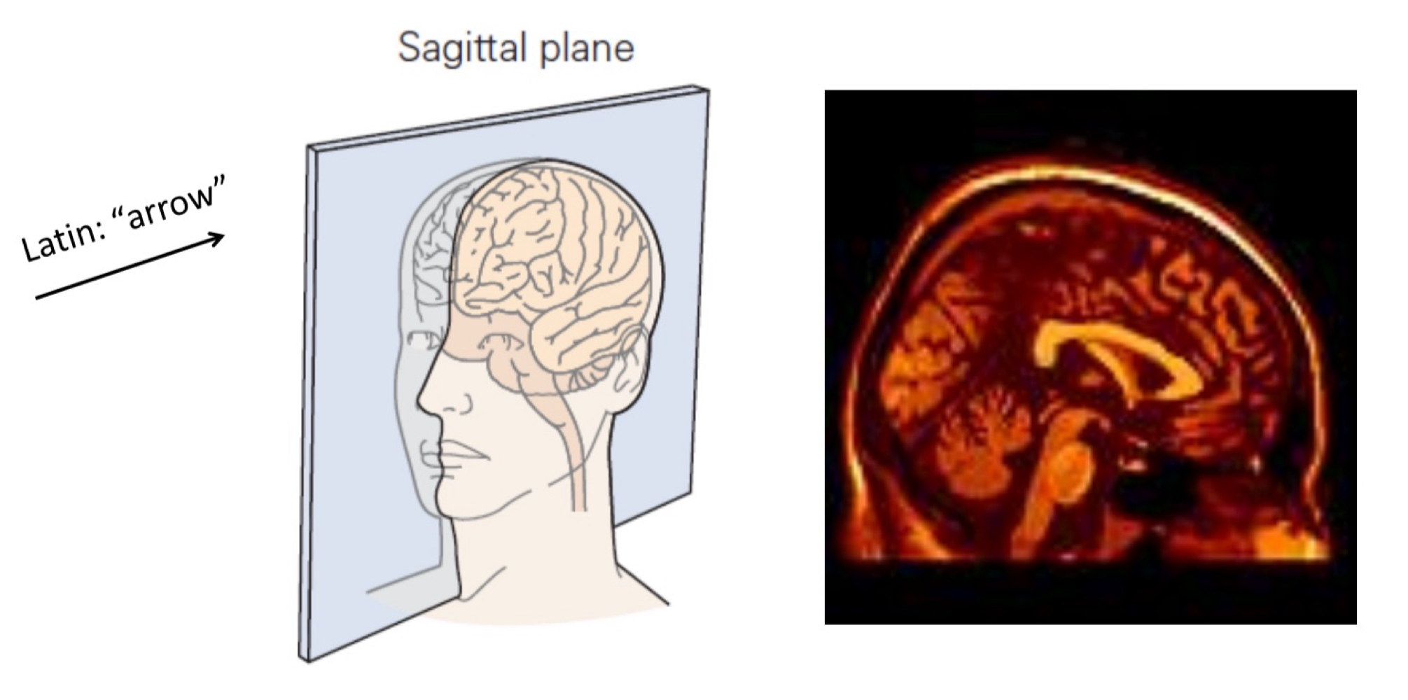 <p>“arrow”, not symmetrical </p>