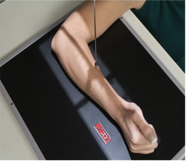 <p>Patient Position </p><p class="p1"><span style="line-height: normal;"><span> </span></span>Similar to wrist</p><p class="p1"><span style="line-height: normal;"><span> </span></span>Patient sitting at side or end of table</p><p class="p1"><span style="line-height: normal;"><span> </span></span>Humerus abducted, elbow flexed 90<span style="line-height: normal;"><span> o</span></span></p><p class="p1"><span style="line-height: normal;"><span> </span></span>Entire upper limb at same height</p><p class="p1"></p><p class="p1">Part Position</p><p class="p1"><span style="line-height: normal;"><span> </span></span>Wrist is placed in a lateral</p><p class="p1"><span style="line-height: normal;"><span> </span></span>Thumb side up (lateromedial)projection</p><p class="p1"></p><p class="p1"> CR</p><p class="p1"><span style="line-height: normal;"><span> </span></span>To midforearm</p><p class="p1"></p><p class="p1">Collimation</p><p class="p1"><span style="line-height: normal;"><span>o </span></span>Same as for AP projection</p>