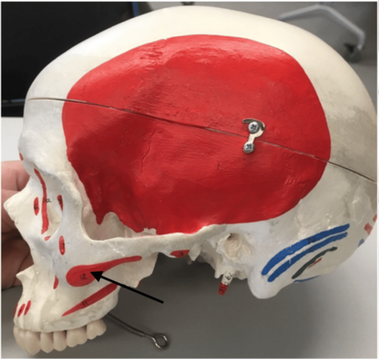 <p>12</p><p>O: Zygomatic arch</p>