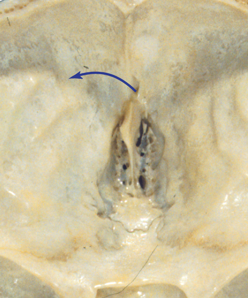 <p>What structure?</p>