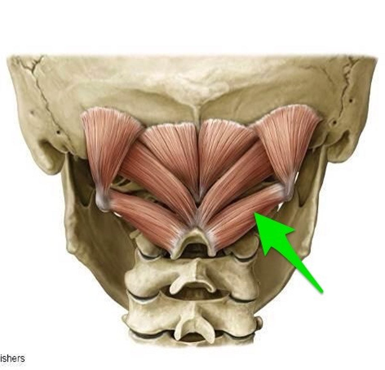 <p>rotate head and neck ipsilaterally</p><p>O: spinous process of C2</p><p>I: transverse process of C1</p><p>N: suboccipital nerve (dorsal ramus of C1)</p>