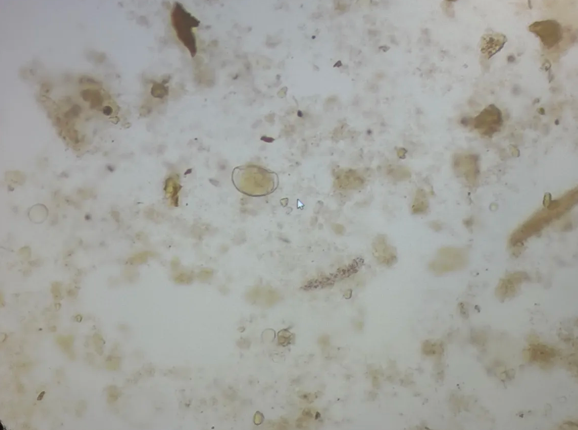 <p>from human stool</p>