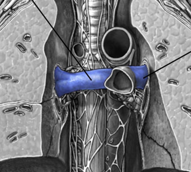 <p>Which vessel of heart:</p><ul><li><p>Branches off from trunk → carries blood to lungs</p></li></ul><p></p>