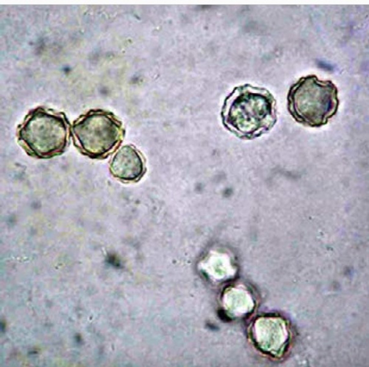 <p>a. Acanthamoeba sp.</p>