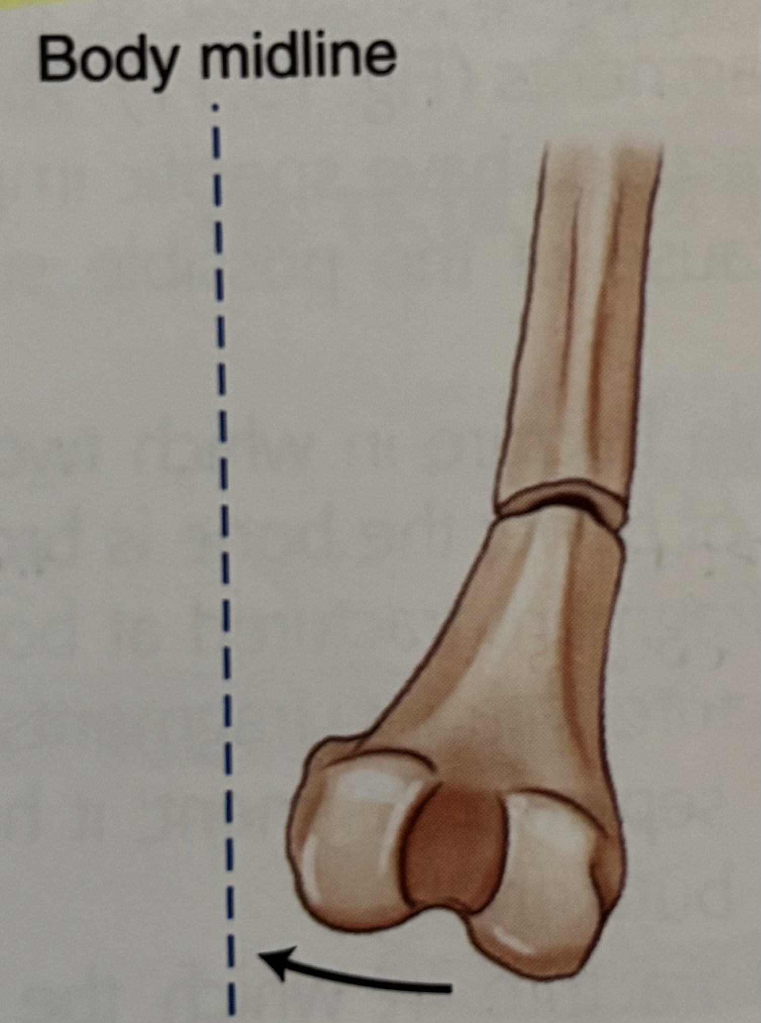 <p>What type of fracture is this?</p>