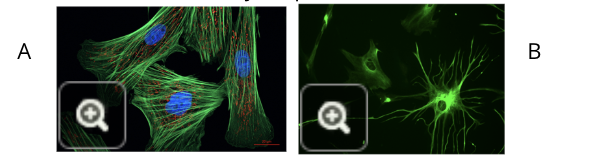 <ul><li><p>Some other cell types can be induced to express MHC II complexes or stimulatory molecules, but normally they don’t</p></li><li><p>this is because these cells will rarely be needed in this specific function and only for short periods of time in case of a sustained inflammatory response</p><ul><li><p>fibroblasts (image A)</p></li><li><p>glial cells (image B)</p></li></ul></li></ul><p></p>