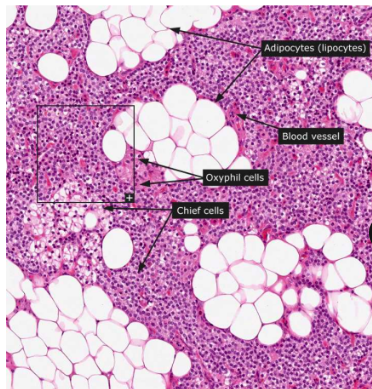 <p>chief cells that produce PTH; oxyphils</p>