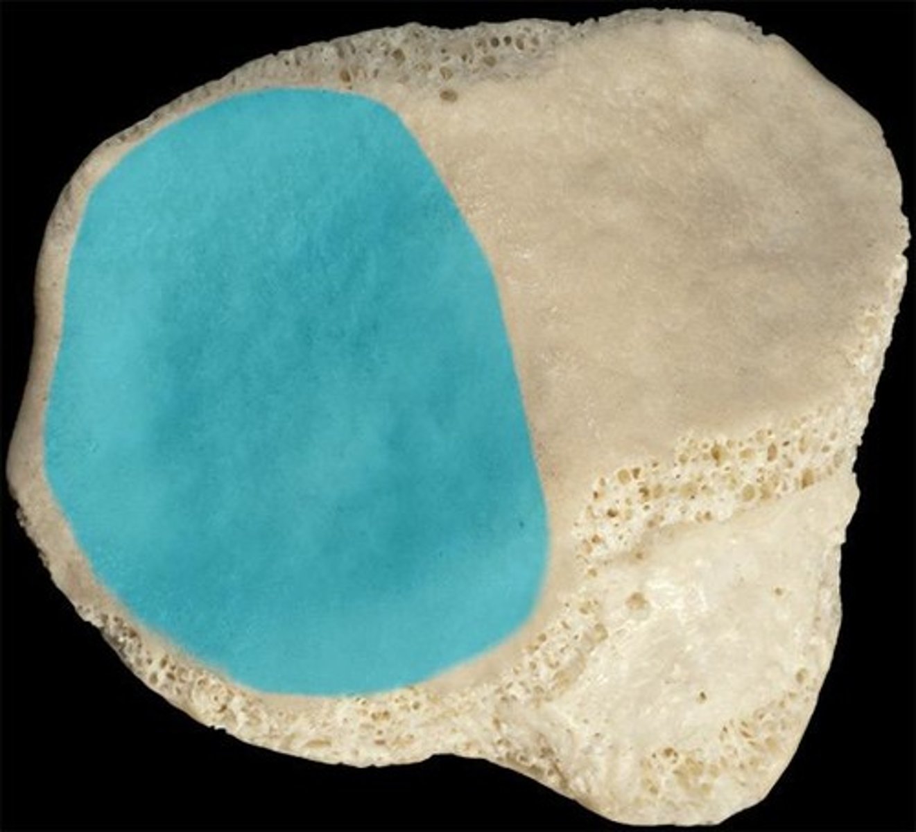 <p>for the distal FEMUR - faces posteriorly and is the largest part of the large articular surface of the PATELLA</p>