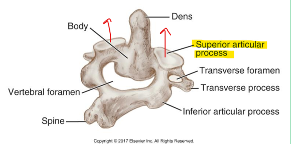 <p>Superior articular process </p>