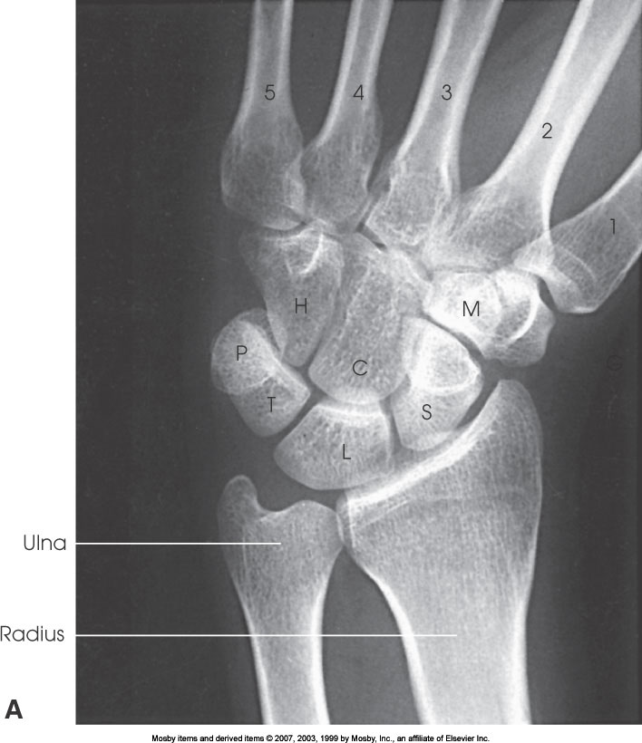 <p>What position is demonstrated?</p>