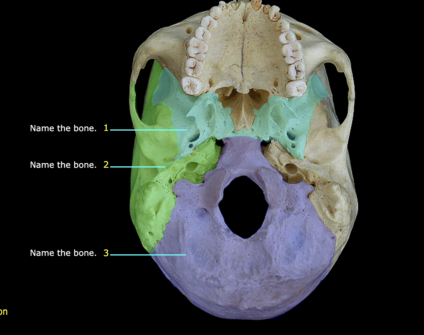 What structure is labeled 2?
