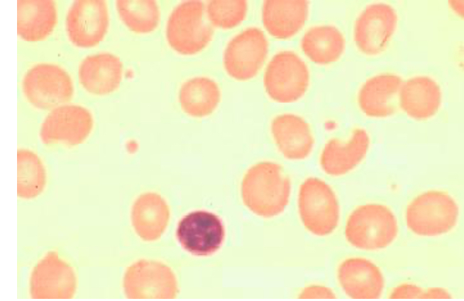 <p>Which MCV confirm this image</p>