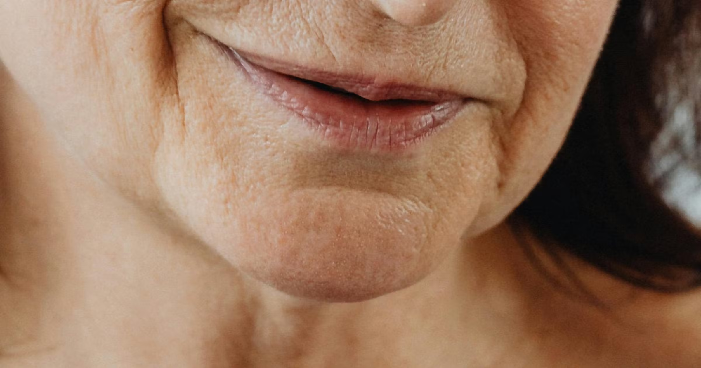 <p>Labiomental sulcus</p><p>(Keywords: CHIN and SULCUS)</p><p>(The mental area pertains to the chin)</p><p>(Sulcus is a furrow) </p>
