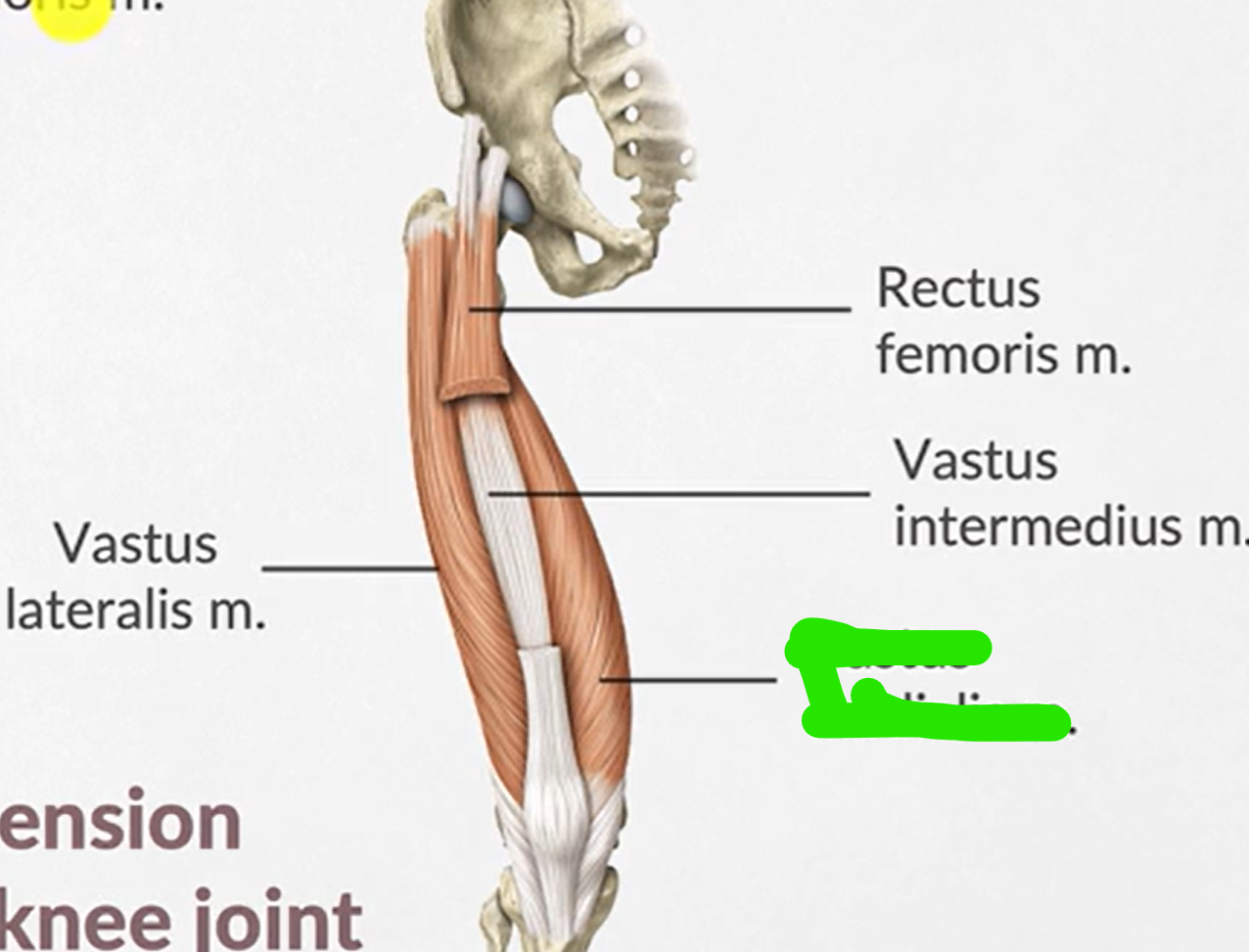 term image