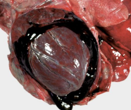 <p>What is the term for blood loss from the heart such as due to a cardiac tamponade, which compresses the atria, blunt force trauma, atrial rupture, aorta rupture, or injections?</p>