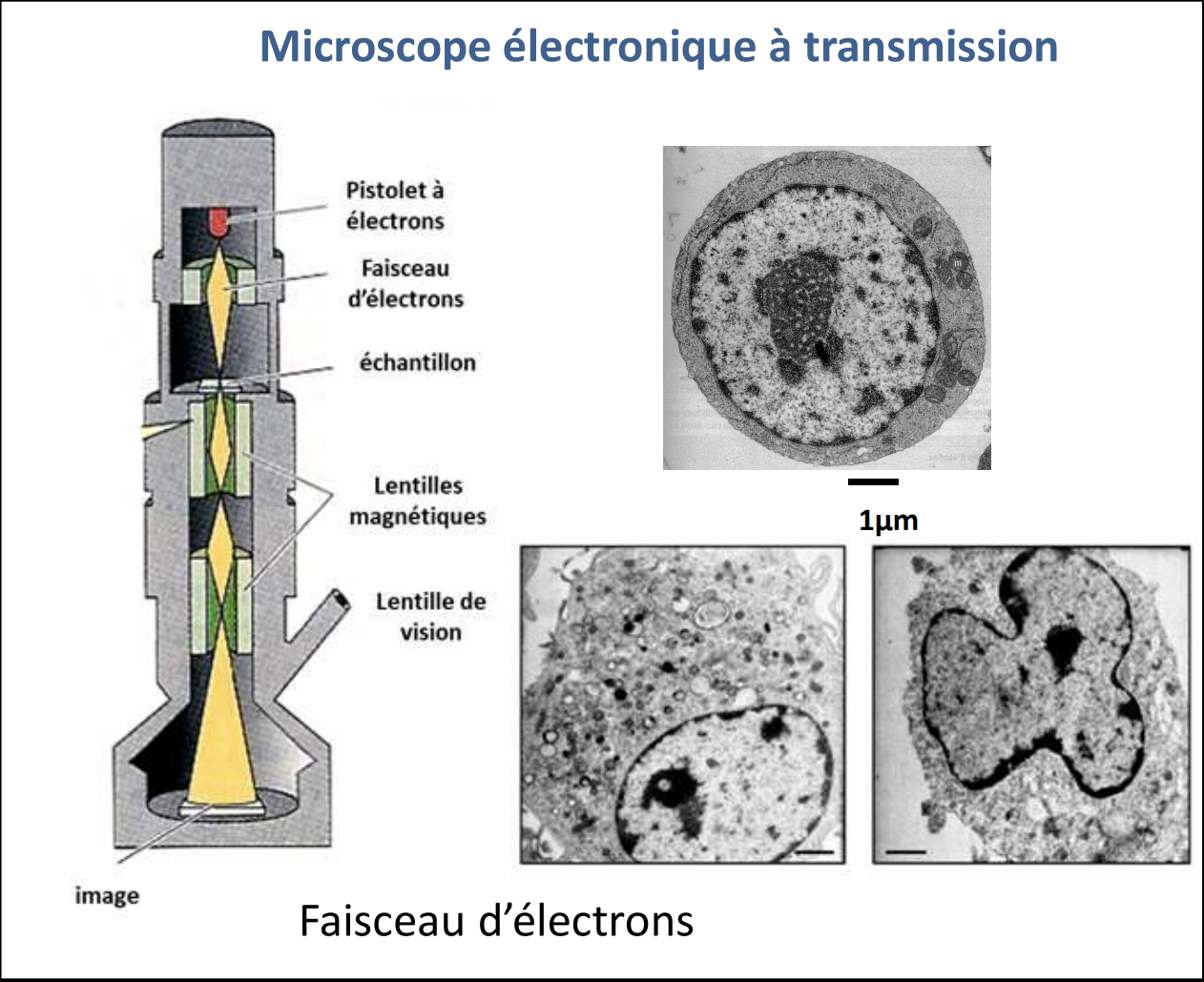 <p>Dans le MET, un pistolet à électrons génère un faisceau d’électrons, qui est ensuite dirigé vers l’échantillon grâce à un système de lentilles magnétiques. L’échantillon, placé sur une grille fine, doit être ultra-mince pour permettre aux électrons de le traverser. Les électrons interagissent avec les diﬀérentes structures de l’échantillon : ils sont plus ou moins retenus ou déviés selon la densité de matière qu’ils rencontrent. Ainsi, les zones denses apparaîtront plus sombres sur l’image finale, tandis que les zones moins denses seront plus claires. L’image obtenue est une vue interne en deux dimensions de l’échantillon, permettant une observation fine de l’organisation intracellulaire</p>