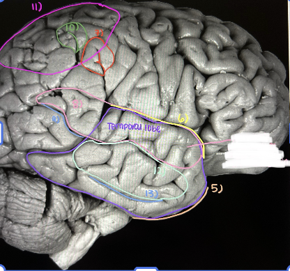 <p>What is under the white?</p>