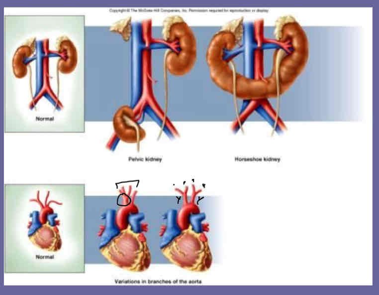 <p>No two humans are exactly alike</p><ul><li><p>Variable # of organs</p></li><li><p>Variation in organ location</p></li></ul>