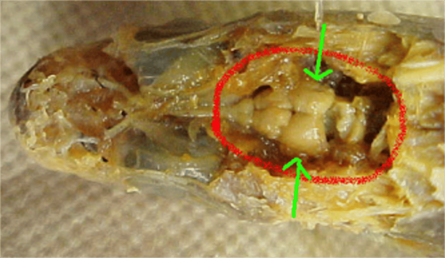<p>A protected organ in the head that receives and processes sensory input from both inside and outside the body</p>