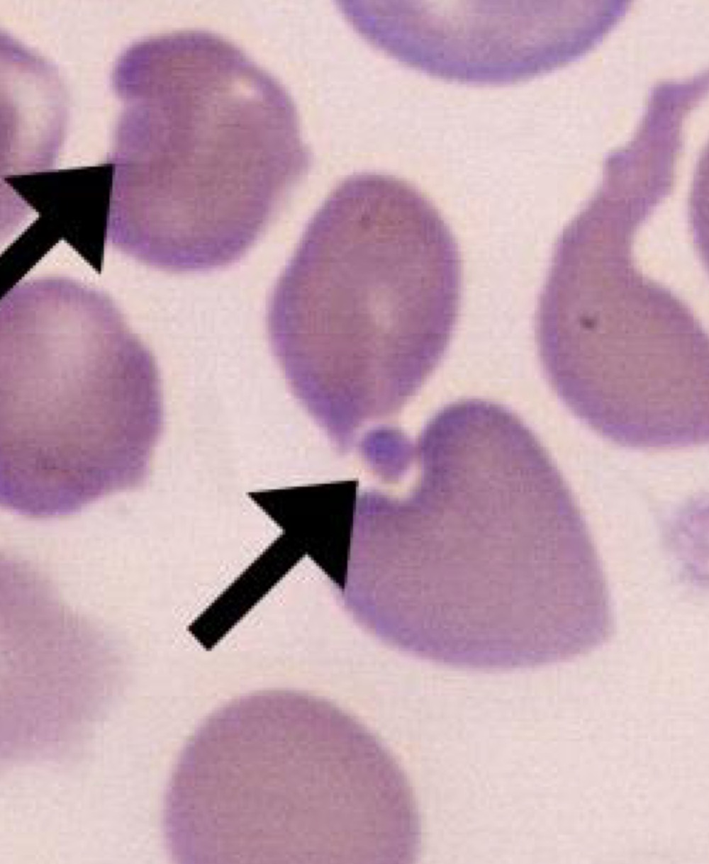 Name this RBC Abnormality.