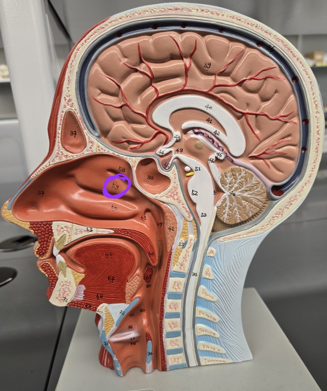 <p>Half head model: what structure is this?</p>
