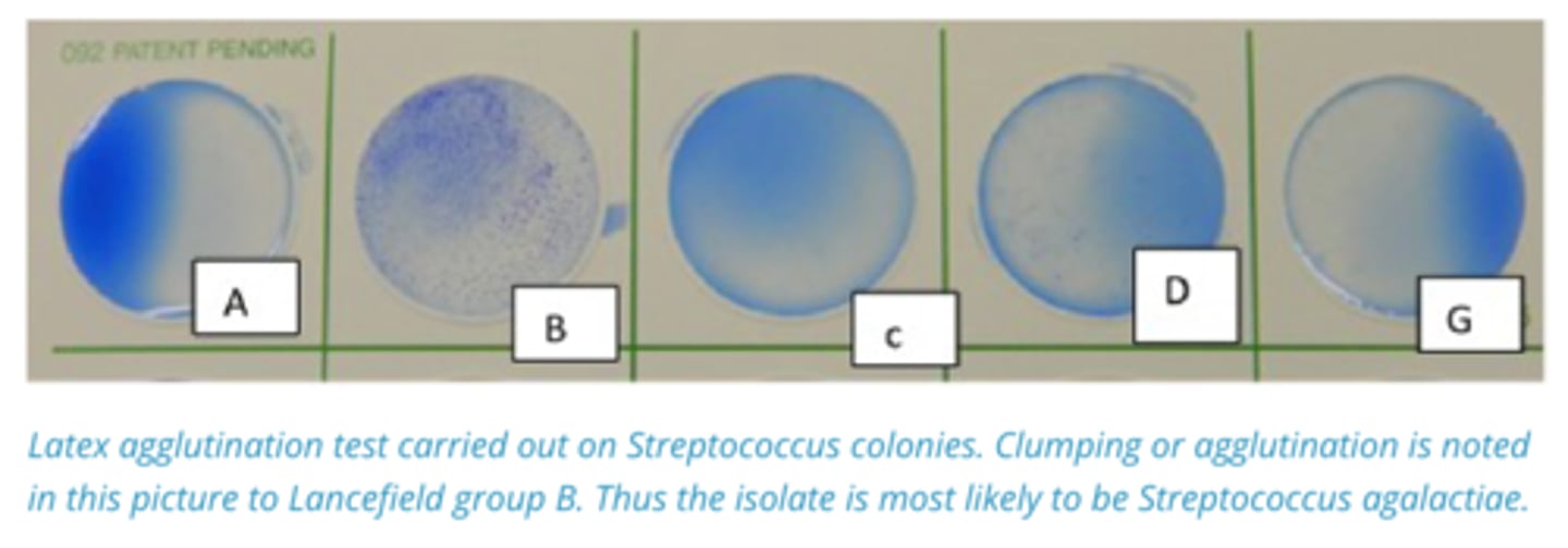 <p>1. Beta-Haemolytic Streptococci are grouped into Lancefield types based on antibodies to Carbohydrates in the Streptococcal cell outer membrane.</p><p>2. Latex agglutination test is used as a method of antigen detection. Clumping of blue particles indicates agglutinating antibodies</p><p>3. Lancefield Group B: Streptococcus agalactiae (Mastitis). CAMP +ve</p>