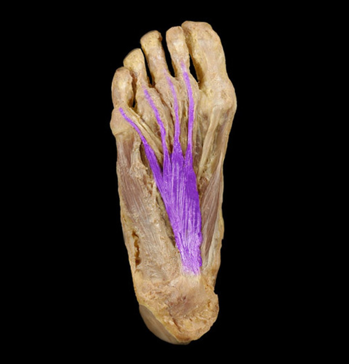 <p>Muscle that flexes the toes and helps maintain balance while walking and standing.</p>