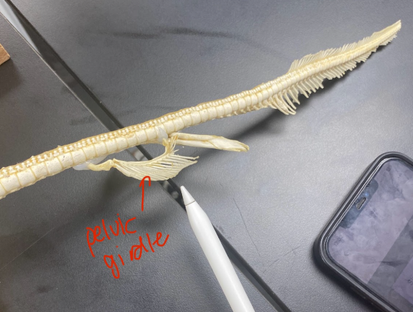 <p>Pelvic girdle </p>