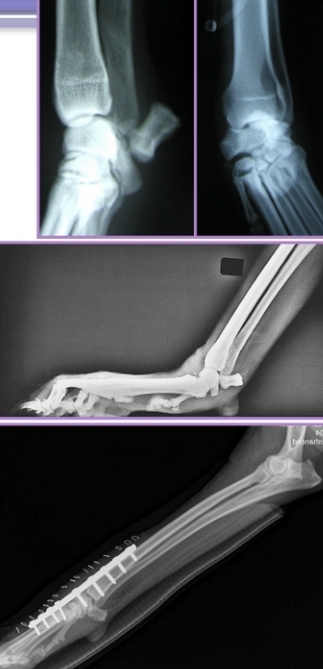 <ul><li><p><span style="background-color: transparent;"><strong><span>Et:</span></strong><span> Palmar fibrocartilage and ligaments torn of loss of support</span></span></p><ul><li><p><span style="background-color: transparent;"><span>fall or hyperextension injury</span></span></p></li></ul></li></ul><ul><li><p><span style="background-color: transparent;"><strong><span>Cs: </span></strong><span>Non-weightbearing lameness, Stand with carpus hyperextended, Palmigrade stance</span></span></p></li></ul><ul><li><p><span style="background-color: transparent;"><strong><span>Dt: </span></strong><span>Radiographs</span></span></p></li><li><p><span style="background-color: transparent;"><strong><span>Tx: </span></strong><span>arthrodesis</span></span></p><ul><li><p><span style="background-color: transparent;"><span>Splinting does not work</span></span></p></li></ul></li></ul><p></p>