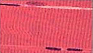 <p>Identifica el tipo de tejido</p>