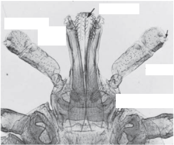 Identify the pointed structure