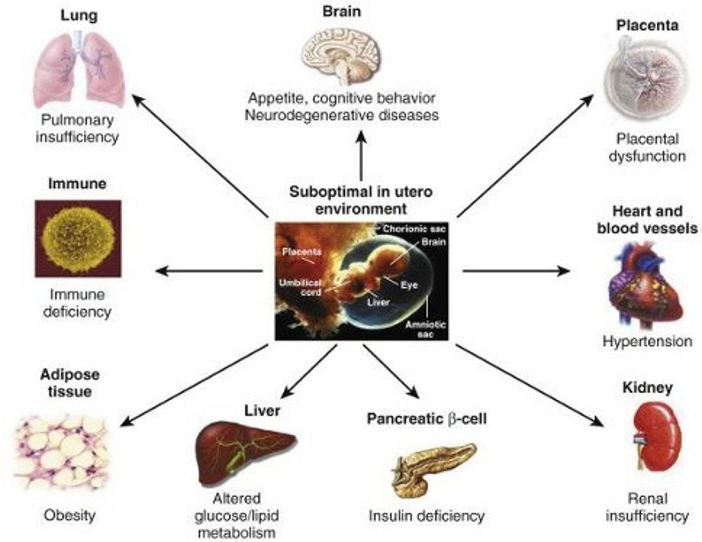 <p>- barker hypothesis</p><p>- fetal programming leading to adult metabolic syndrome</p>