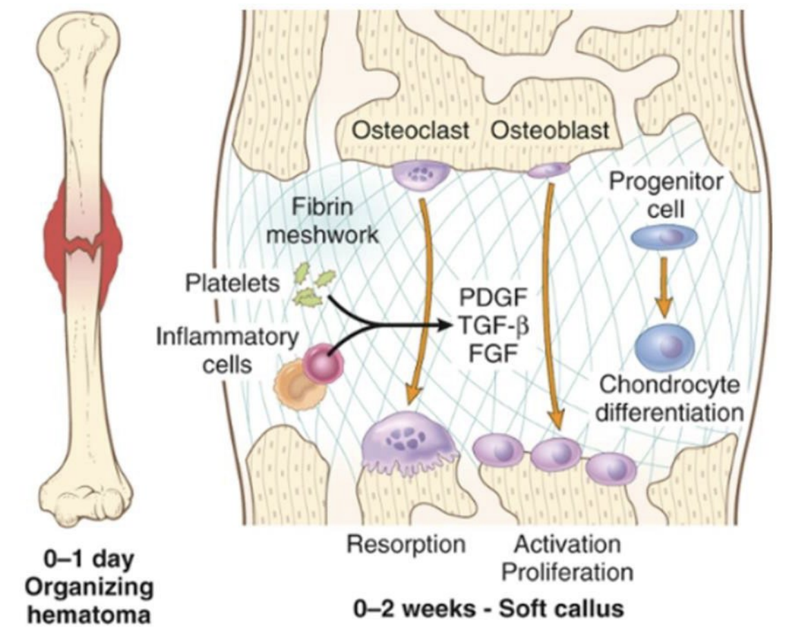 <p>fracture: phase of secondary healing?</p>