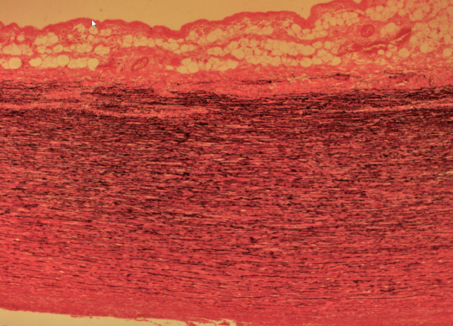 <p>A type of connective tissue that contains a high concentration of elastic fibers, allowing for stretch and recoil. It is found in structures such as the walls of large arteries and the lungs. </p>