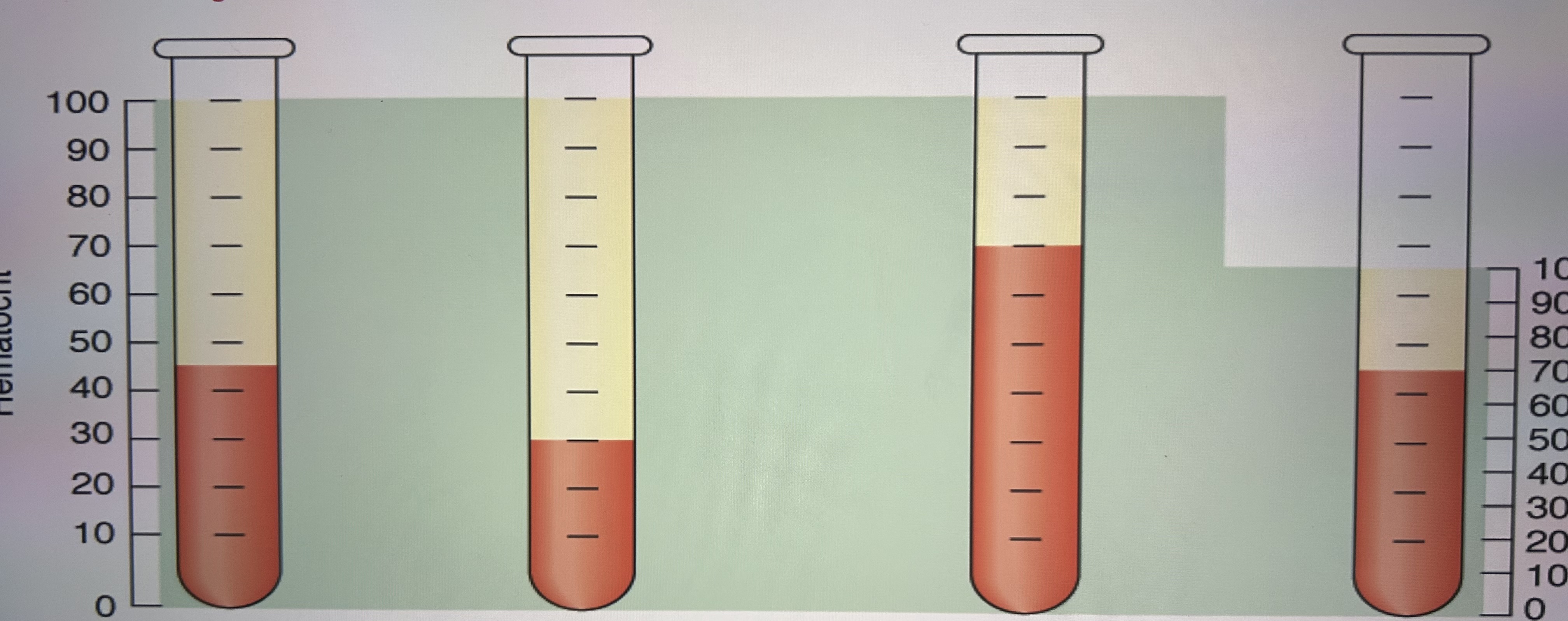 <p>What is seen in each diagram?</p>