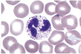 <p>granulocyte</p><ul><li><p>4 lobes</p></li></ul>