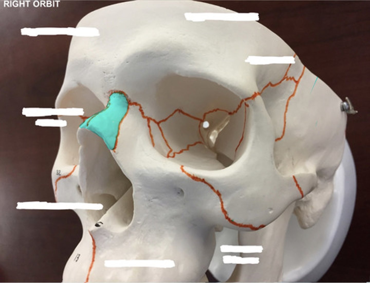 <p>What bone is highlighted here?</p>
