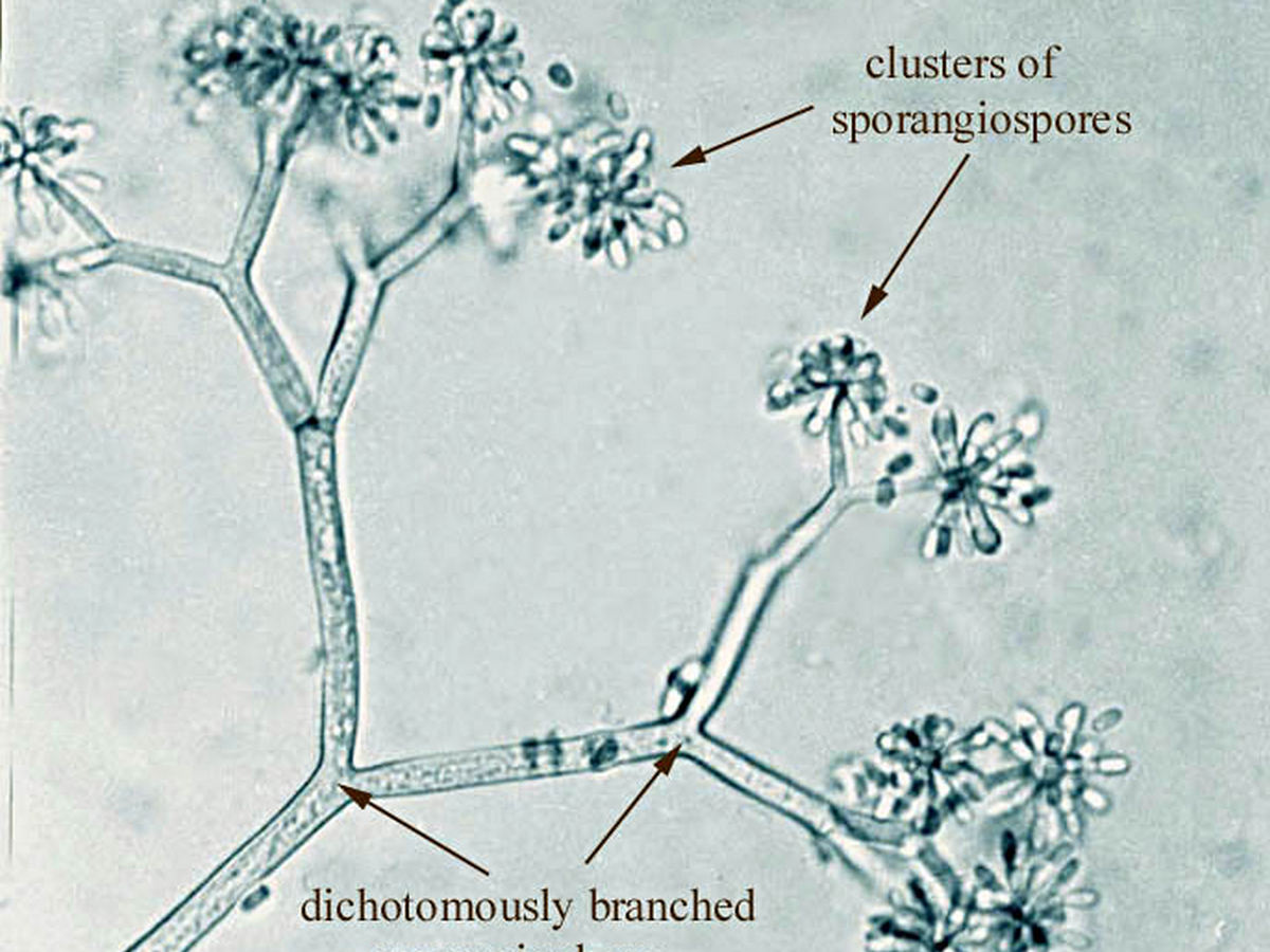 <p>Which fungi is this?</p>