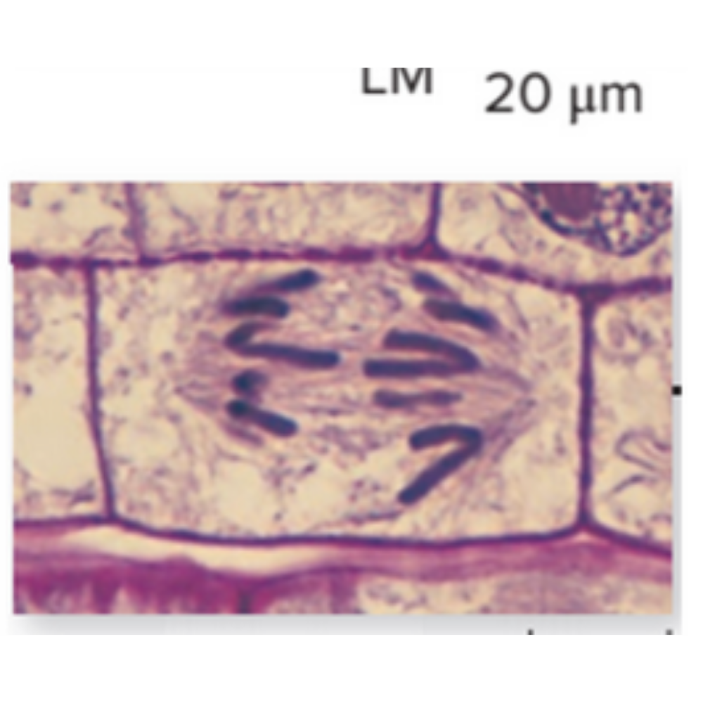 <p>What kind of cell is shown? Name the phase that it is experiencing.</p>