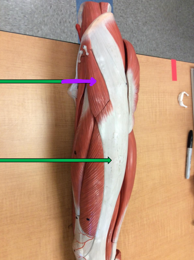 <p>Identify this muscle?</p>